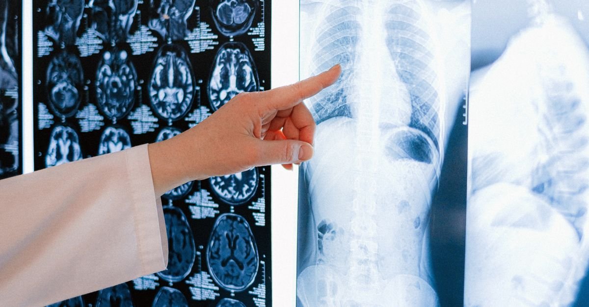 Mão de profissional de saúde aponta para radiografia de tórax em negatoscópio, ao lado de imagens de ressonância